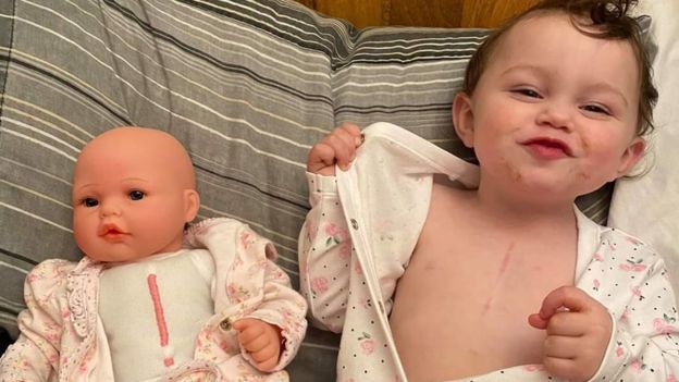Dolls Made With Cleft Lips And Heart Surgery Scars Bbc News
