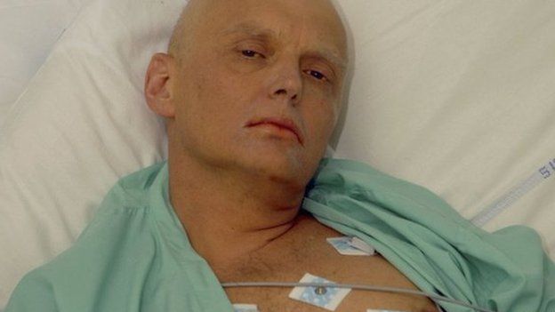 Alexander Litvinenko is pictured at the Intensive Care Unit