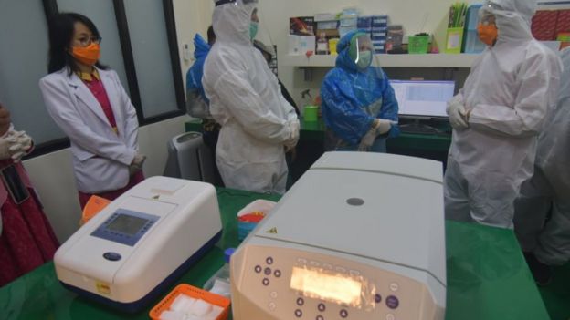 PCR