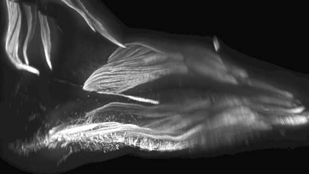 Az evolúció valószínűleg legősibb maradványát fedezték fel az emberi magzatban | 2019. 10. 03. A scan of a baby's muscles in the foot