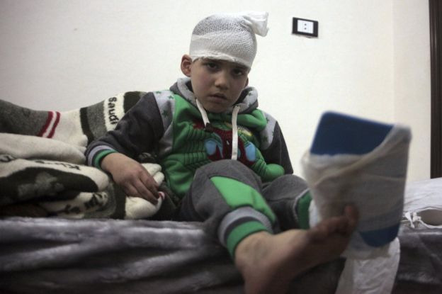 An injured boy from east Aleppo sits in a hospital bed near Idlib, 16 December