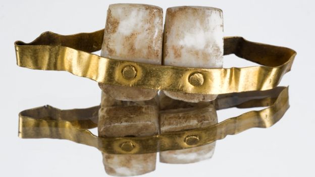 Dentadura en oro con dos dientes inferiores. Copia de la descubierta en una tumba en Etruria, Italia, de circa 700 a.C.