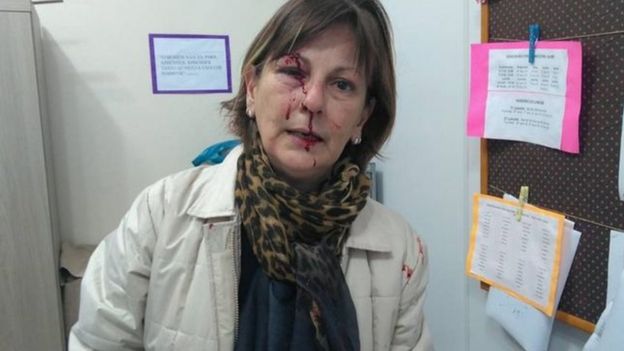 Professora Marcia Friggi após agressão em sala de aula