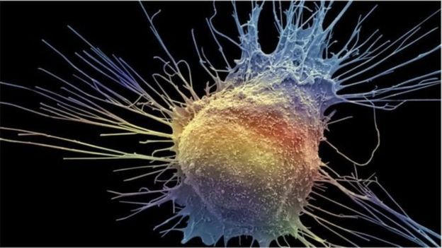 புற்றுநோய்