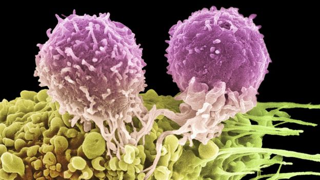 Два Т-лимфоцита на раковой клетке