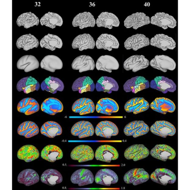 Reconstrucción en 3D de la superficie del cerebro de los recién nacidos, a partir de imágenes por resonancia magnética (IRM).