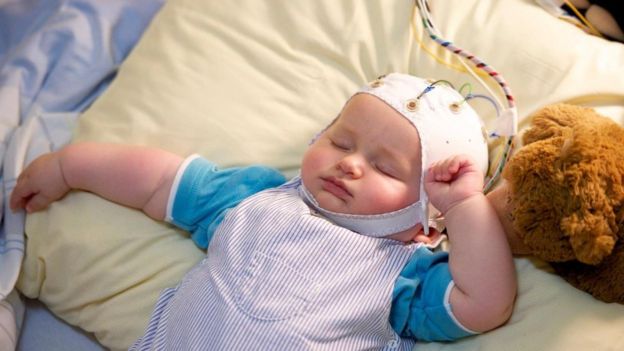 Bebé durmiendo con electrodos conectados a la cabeza
