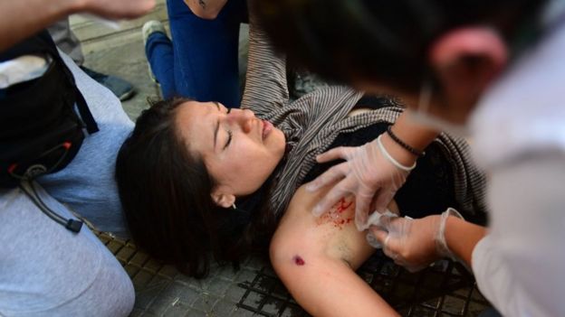 Mujer siendo atendida en el suelo tras sufrir una herida.