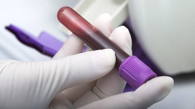 Foto de exame de sangue convencional
