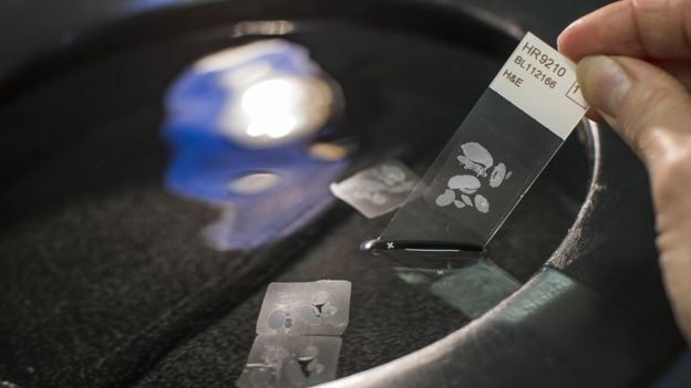 Cells being tested at the Cancer Research UK Cambridge Institute