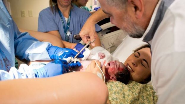 Aline Villa segura o filho recém-nascido rodeada pela equipe médica