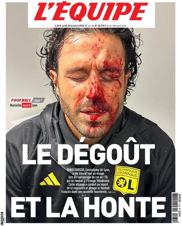 L'Equipe front page showing Fabio Grosso's bloodied face