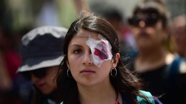 Manifestante chilena con una venda en el ojo