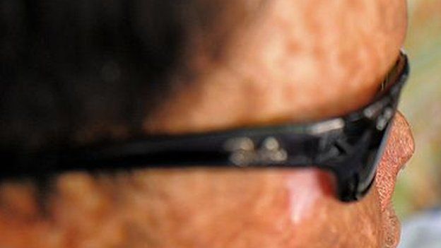 অ্যাসিডে দগ্ধ চোখ (ফাইল ফটো)