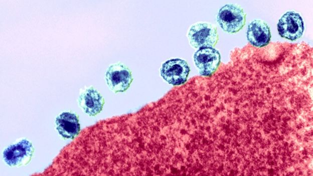 Célula infectada con VIH