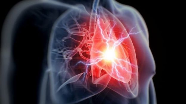 عادة ما يكون الرجال أكثر عرضة لآلام الصدر من النساء، عند الإصابة بنوبة قلبية : GETTY IMAGES