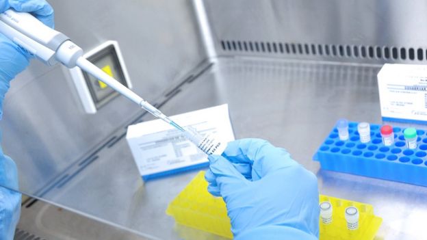 Teste para coronavírus produzido pela Fiocruz