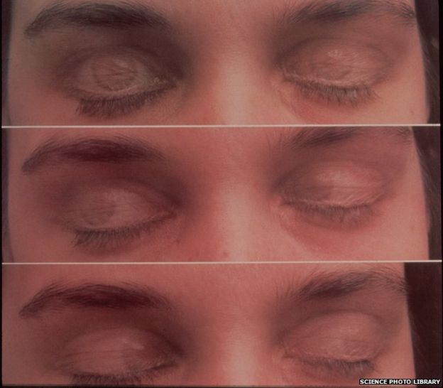 Eye movements 'change scenes' during dreams BBC News