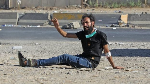 An Iraqi protester gestures after being shot during a demonstration in Baghdad on 4 October 2019