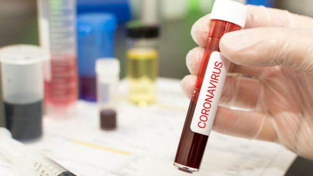 Una mano sujeta una probeta de laboratorio con sangre