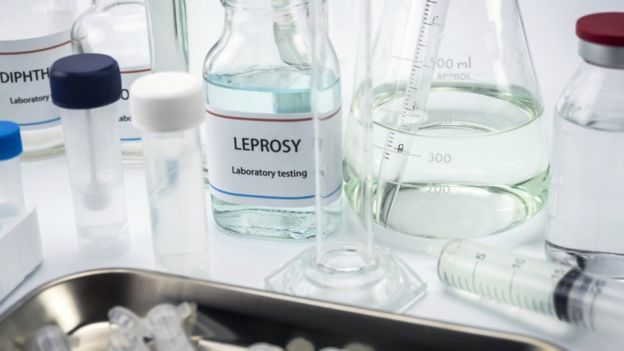 Vidros e equipamentos de laboratório, um deles com o rótulo indicando o nome da hansenÃase em inglês
