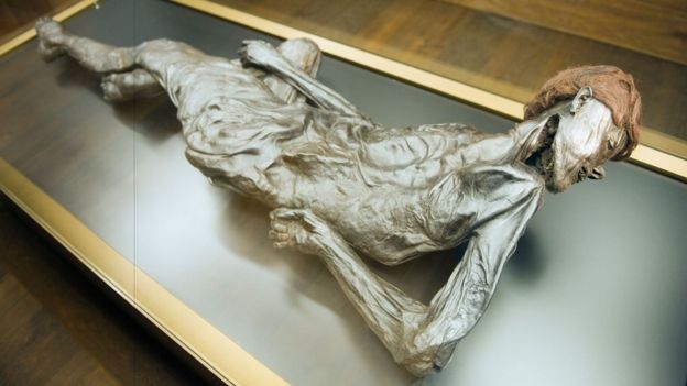Grauballe Man, the main attraction of the Moesgaard Museum, died when his throat was slit