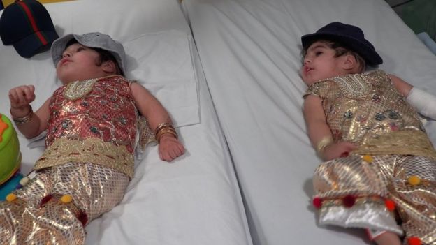 அறுவை சிகிச்சைக்கு பிறகு