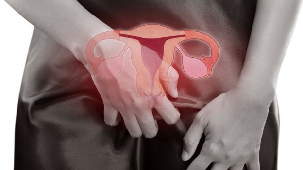 Montaje de la pelvis de una mujer con una ilustración de sus órganos reproductivos supuerpuesta