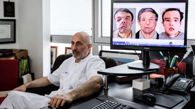 Laurent Lantieri