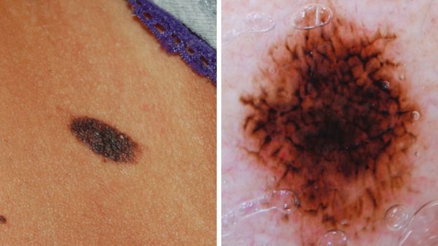  Dangerous Tanning Products Promoted By Influencers BBC News