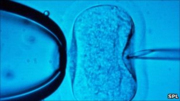 Test 'predicts' success of IVF after one cycle - BBC News