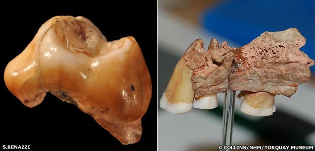 Teeth and jaw are from 'earliest Europeans'