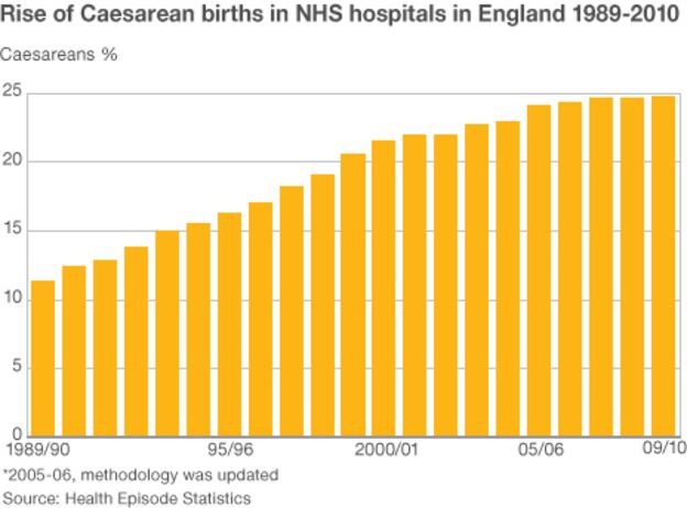 Women can choose Caesarean birth - BBC News