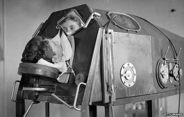 Iron Lung, 1938