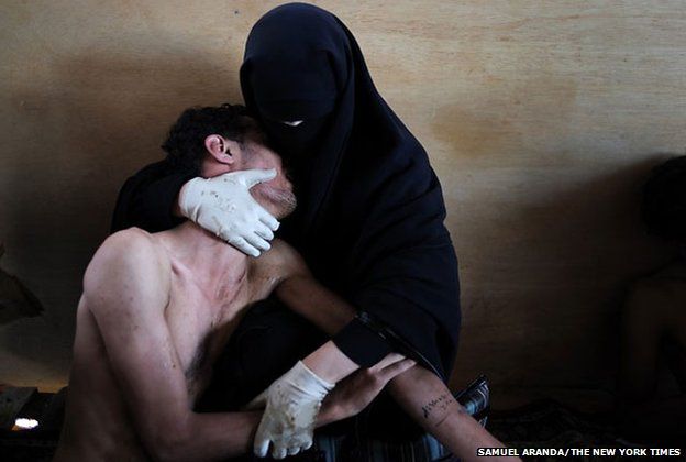 A woman holding a wounded relative during protests against president Saleh in Sanaa, Yemen October 15, 2011.
