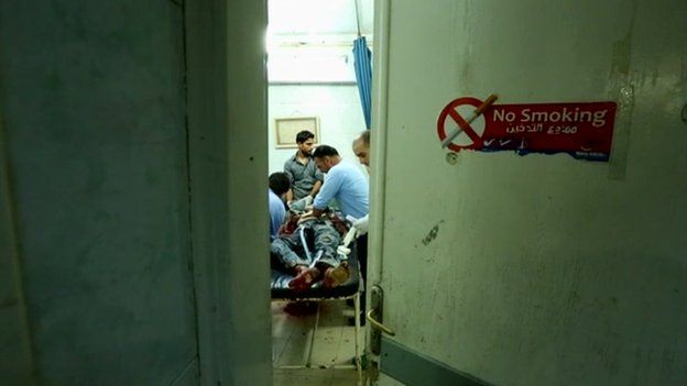A view of one of the two operating beds in the Aleppo hospital