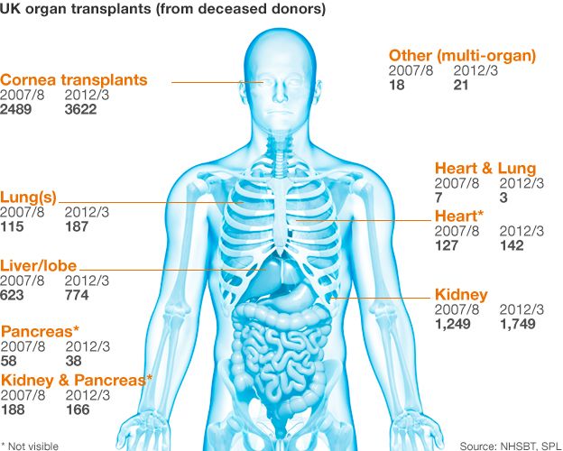 Organ donation graphic