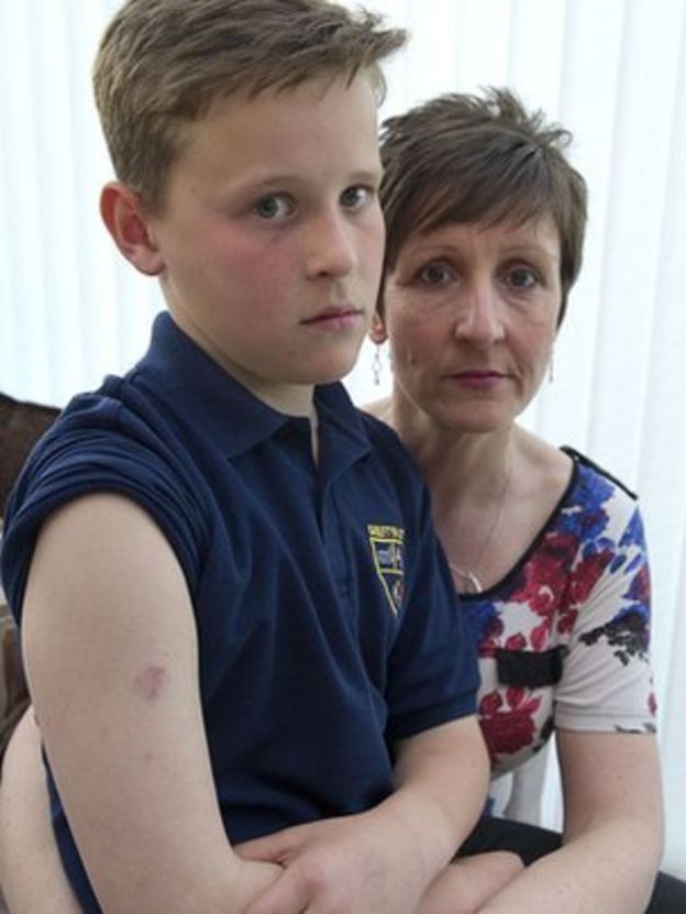 Luis Suarez Copycat Bites Pupil Claims Mum Sharon Ellis Bbc News 