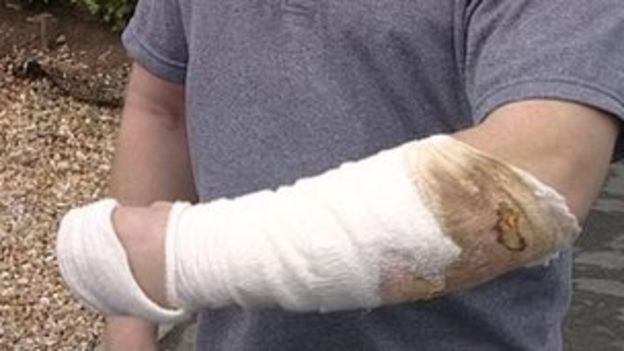 Stunning Dog Seriously Injures Four People West Of Melbourne View Photography Stunning Dog Seriously Injures Four People West Of Melbourne View Photography