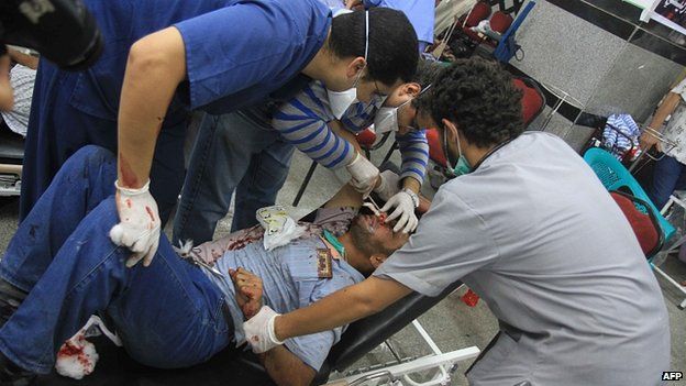 Injured Morsi supporter treated at field hospital
