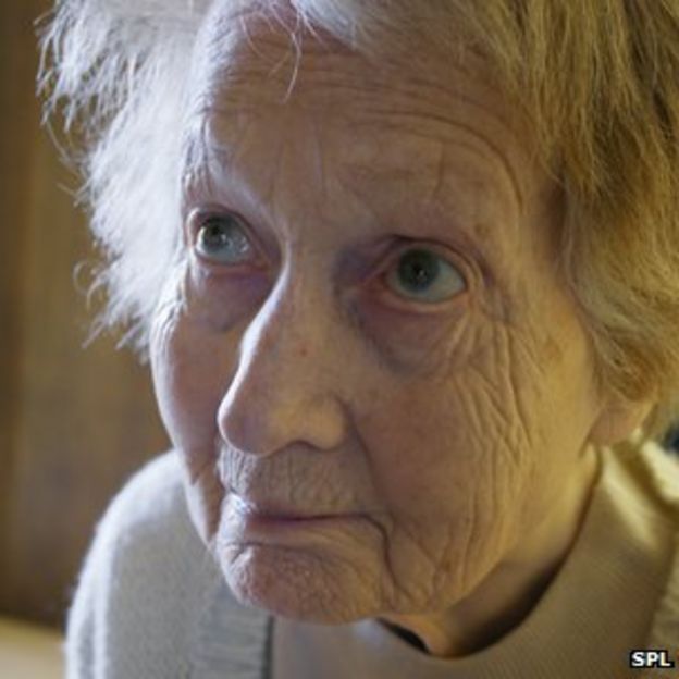 Alzheimer's insight from DNA study - BBC News