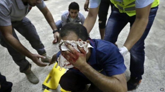 Injured man at blast scene, south Beirut (19 Nov)