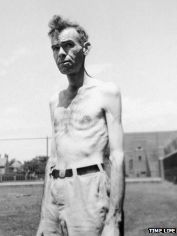 results of the minnesota starvation experiment