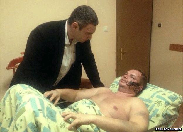 Vitali Klitschko visits Dmytro Bulatov in hospital