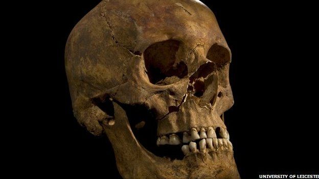 Skull of Richard III