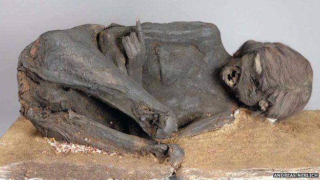 Frontal view of the mummy which reveals typical squatting position