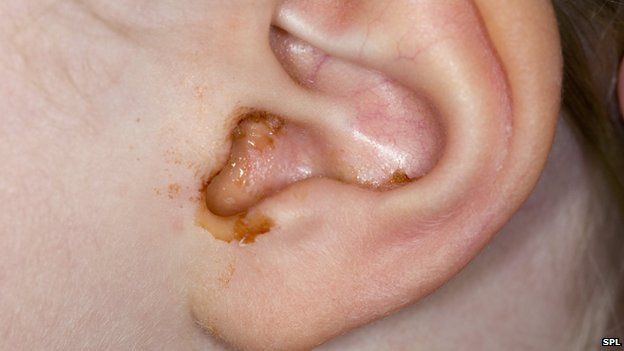 ear wax