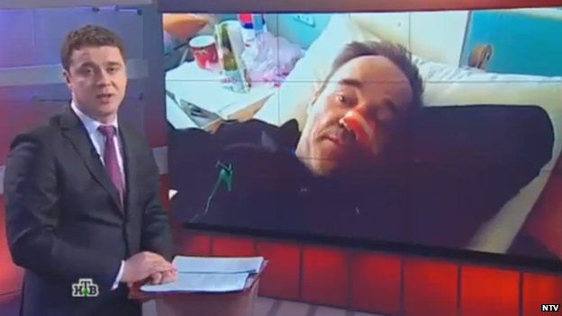 Screenshot of a news bulletin on NTV with an activist in a hospital bed