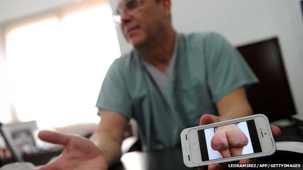 Doctor in scrubs holds out a phone with a picture of disfigured buttocks on the screen.