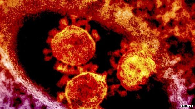 Particles of the Middle East respiratory syndrome (MERS) coronavirus that emerged in 2012 are seen in an undated colorized transmission electron micrograph